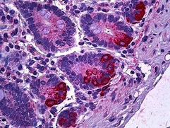 Immunohistochemistry (Formalin/PFA-fixed paraffin-embedded sections) - Anti-IL-12 antibody (AB124635)