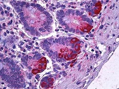 Immunohistochemistry (Formalin/PFA-fixed paraffin-embedded sections) - Anti-IL-12 antibody (AB124635)