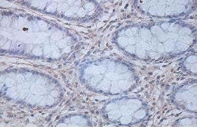 Immunohistochemistry (Formalin/PFA-fixed paraffin-embedded sections) - Anti-IL-12 p40 antibody (AB106270), expandable thumbnail