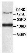 Western blot - Anti-IL-12 p40 antibody (AB106270), expandable thumbnail