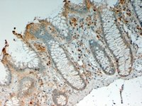 Immunohistochemistry (Formalin/PFA-fixed paraffin-embedded sections) - Anti-IL-12 p40 antibody (AB62822)