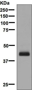 Western blot - Anti-IL-12 p40 antibody [EPR5738] - BSA and Azide free (AB214444)