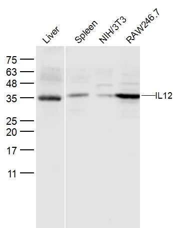 Western blot - Anti-IL-12A antibody (AB203031)