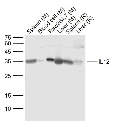 Western blot - Anti-IL-12A antibody (AB203031)