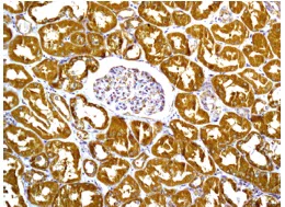 Immunohistochemistry (Formalin/PFA-fixed paraffin-embedded sections) - Anti-IL-12A antibody [EP5737] - BSA and Azide free (AB214433)