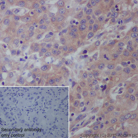 Immunohistochemistry (Formalin/PFA-fixed paraffin-embedded sections) - Anti-IL-12A antibody [EP5737] - BSA and Azide free (AB214433)