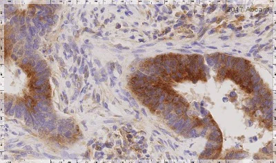 Immunohistochemistry (Formalin/PFA-fixed paraffin-embedded sections) - Anti-IL-12A antibody [EP5737] - BSA and Azide free (AB214433)