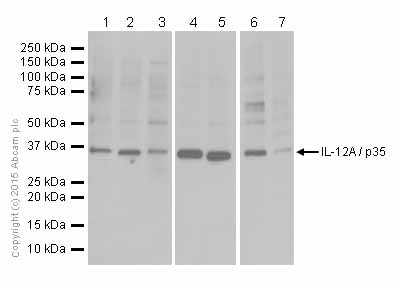 Western blot - Anti-IL-12A antibody [EPR5736] (AB133751), expandable thumbnail