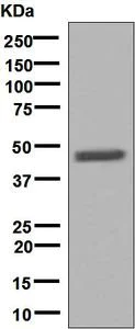 Western blot - Anti-IL-12B antibody [EPR5739] (AB133752)