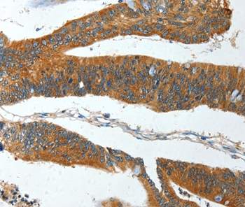 Immunohistochemistry (Formalin/PFA-fixed paraffin-embedded sections) - Anti-IL-12RB1 antibody (AB197685)