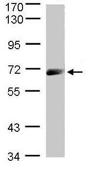 Western blot - Anti-IL-12RB1 antibody (AB96517), expandable thumbnail
