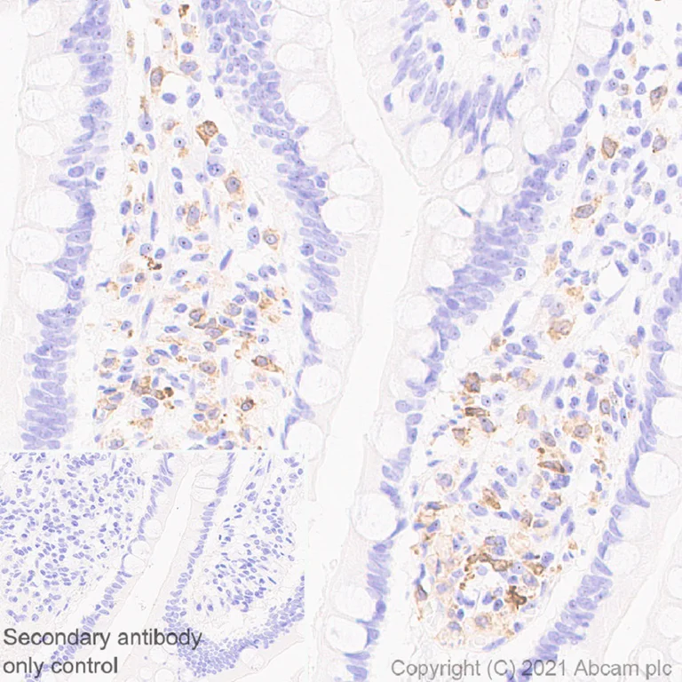 Immunohistochemistry (Formalin/PFA-fixed paraffin-embedded sections) - Anti-IL-12RB1 antibody [EPR23693-37] (AB256805)