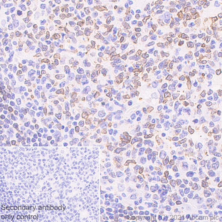Immunohistochemistry (Formalin/PFA-fixed paraffin-embedded sections) - Anti-IL-12RB1 antibody [EPR23693-37] - BSA and Azide free (AB280892), expandable thumbnail