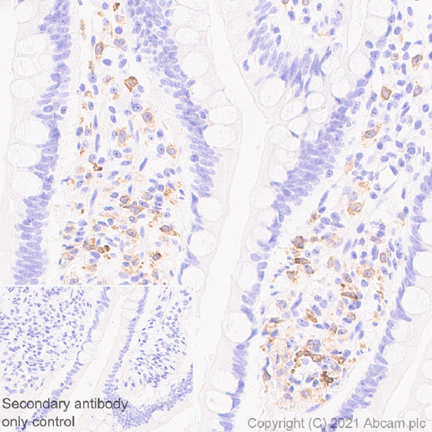 Immunohistochemistry (Formalin/PFA-fixed paraffin-embedded sections) - Anti-IL-12RB1 antibody [EPR23693-37] - BSA and Azide free (AB280892), expandable thumbnail