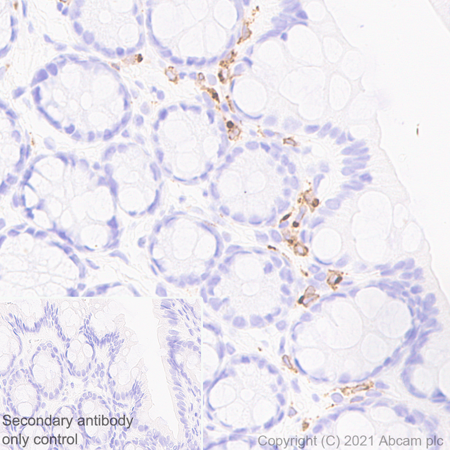 Immunohistochemistry (Formalin/PFA-fixed paraffin-embedded sections) - Anti-IL-12RB1 antibody [EPR23693-37] - BSA and Azide free (ab280892), expandable thumbnail