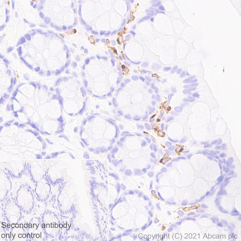 Immunohistochemistry (Formalin/PFA-fixed paraffin-embedded sections) - Anti-IL-12RB1 antibody [EPR23693-37] - BSA and Azide free (AB280892)