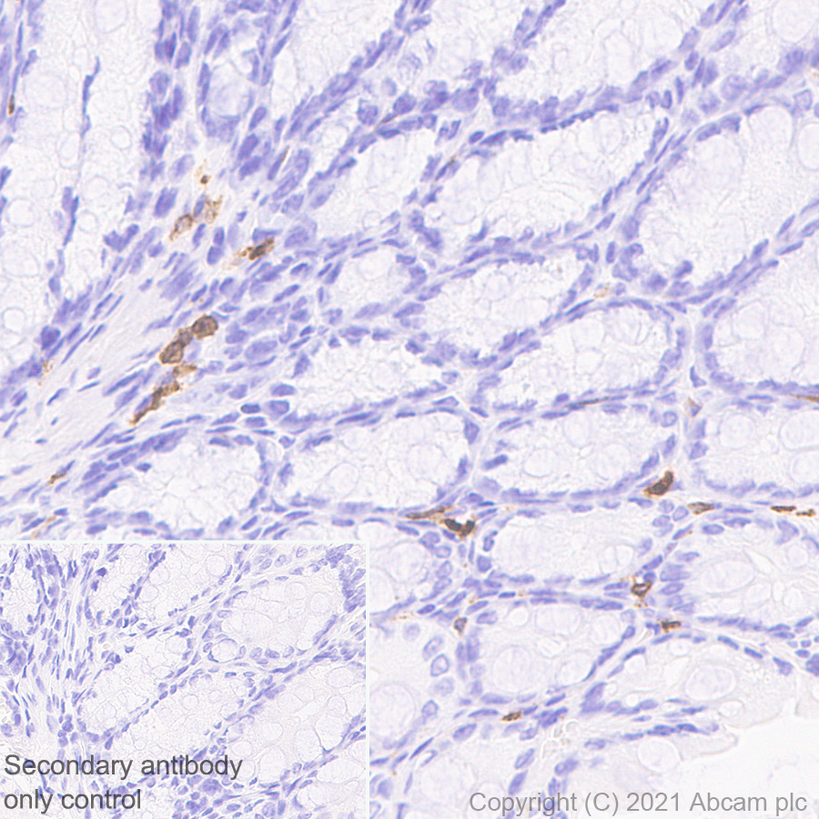 Immunohistochemistry (Formalin/PFA-fixed paraffin-embedded sections) - Anti-IL-12RB1 antibody [EPR23693-37] - BSA and Azide free (ab280892), expandable thumbnail