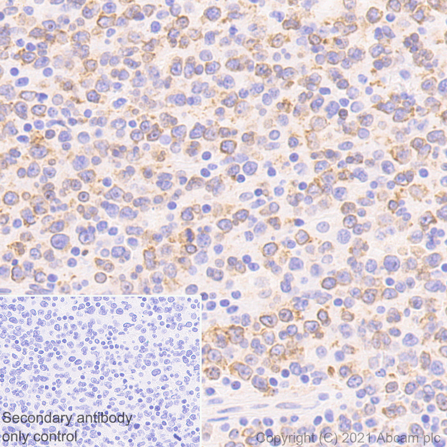 Immunohistochemistry (Formalin/PFA-fixed paraffin-embedded sections) - Anti-IL-12RB1 antibody [EPR23693-37] - BSA and Azide free (AB280892), expandable thumbnail