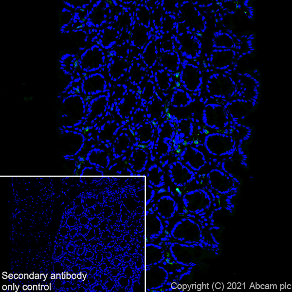 Immunohistochemistry (Frozen sections) - Anti-IL-12RB1 antibody [EPR23693-37] - BSA and Azide free (AB280892), expandable thumbnail