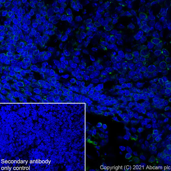 Immunohistochemistry (Frozen sections) - Anti-IL-12RB1 antibody [EPR23693-37] - BSA and Azide free (AB280892)