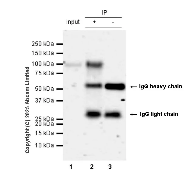 Immunoprecipitation - Anti-IL-12RB1 antibody [EPR28354-118] (AB325502)