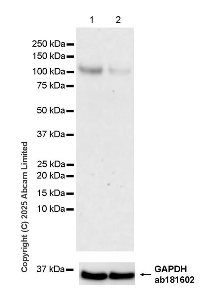 Western blot - Anti-IL-12RB1 antibody [EPR28354-118] (AB325502)