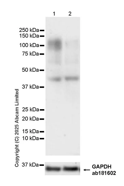 Western blot - Anti-IL-12RB1 antibody [EPR28354-118] - BSA and Azide free (AB325507)