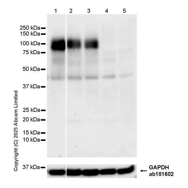 Western blot - Anti-IL-12RB1 antibody [EPR28354-118] - BSA and Azide free (AB325507)