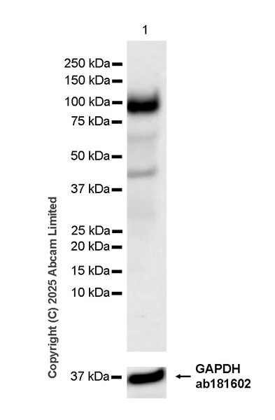 Western blot - Anti-IL-12RB1 antibody [EPR28354-118] - BSA and Azide free (AB325507)