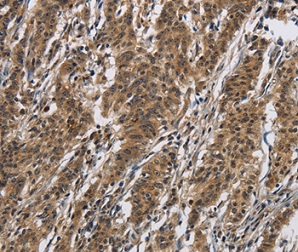 Immunohistochemistry (Formalin/PFA-fixed paraffin-embedded sections) - Anti-IL-12RB2 antibody (AB198833), expandable thumbnail