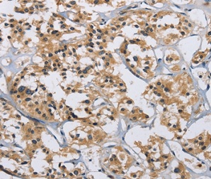 Immunohistochemistry (Formalin/PFA-fixed paraffin-embedded sections) - Anti-IL-12RB2 antibody (AB198833), expandable thumbnail