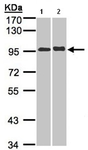 Western blot - Anti-IL-12RB2 antibody (AB96097)