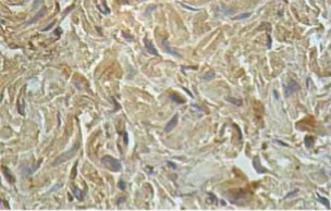 Immunohistochemistry (Formalin/PFA-fixed paraffin-embedded sections) - Anti-IL-13 receptor alpha 1 antibody (AB108499)