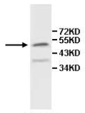 Western blot - Anti-IL-13 receptor alpha 1 antibody (AB108499)