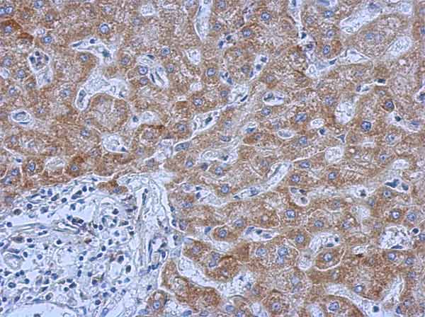 Immunohistochemistry (Formalin/PFA-fixed paraffin-embedded sections) - Anti-IL-13 receptor alpha 1 antibody (AB154380), expandable thumbnail