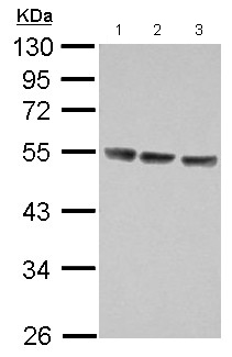 Western blot - Anti-IL-13 receptor alpha 1 antibody (AB154380), expandable thumbnail