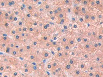Immunohistochemistry (Formalin/PFA-fixed paraffin-embedded sections) - Anti-IL-13 receptor alpha 1 antibody (AB233528)