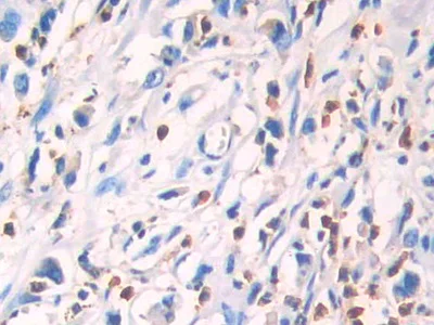 Immunohistochemistry (Formalin/PFA-fixed paraffin-embedded sections) - Anti-IL-13 receptor alpha 1 antibody (AB233528)
