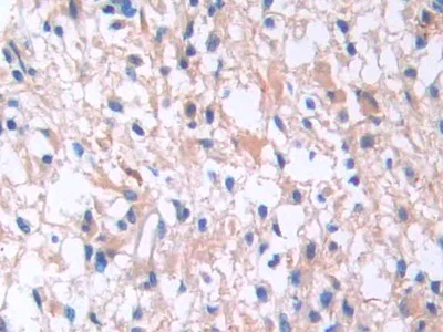 Immunohistochemistry (Formalin/PFA-fixed paraffin-embedded sections) - Anti-IL-13 receptor alpha 1 antibody (AB233528)