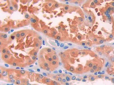 Immunohistochemistry (Formalin/PFA-fixed paraffin-embedded sections) - Anti-IL-13 receptor alpha 1 antibody (AB233528)