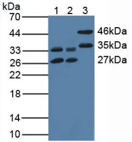 Western blot - Anti-IL-13 receptor alpha 1 antibody (AB233528)