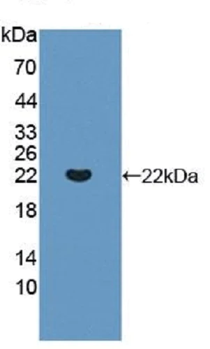 Western blot - Anti-IL-13 receptor alpha 1 antibody (AB233528)