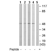 Western blot - Anti-IL-13 receptor alpha 1 antibody (AB79277)