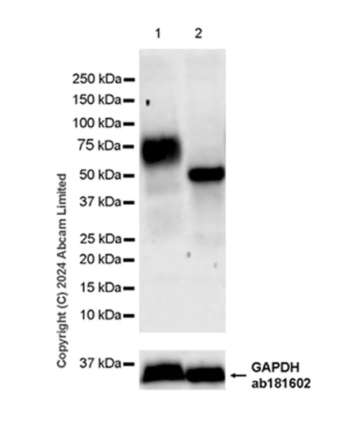 Western blot - Anti-IL-13 receptor alpha 1 antibody [EPR28795-26] - BSA and Azide free (AB322050)