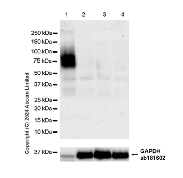 Western blot - Anti-IL-13 receptor alpha 1 antibody [EPR28795-26] - BSA and Azide free (AB322050)