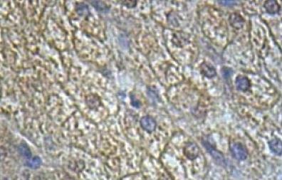 Immunohistochemistry (Formalin/PFA-fixed paraffin-embedded sections) - Anti-IL-13 receptor alpha 2 antibody (AB108534)