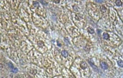 Immunohistochemistry (Formalin/PFA-fixed paraffin-embedded sections) - Anti-IL-13 receptor alpha 2 antibody (AB108534)