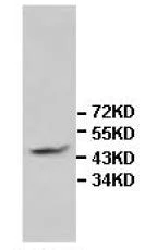 Western blot - Anti-IL-13 receptor alpha 2 antibody (AB108534)