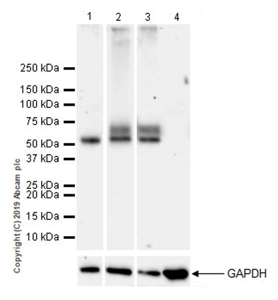 Western blot - Anti-IL-13 receptor alpha 2 antibody [EPR22978-163] (AB260044), expandable thumbnail