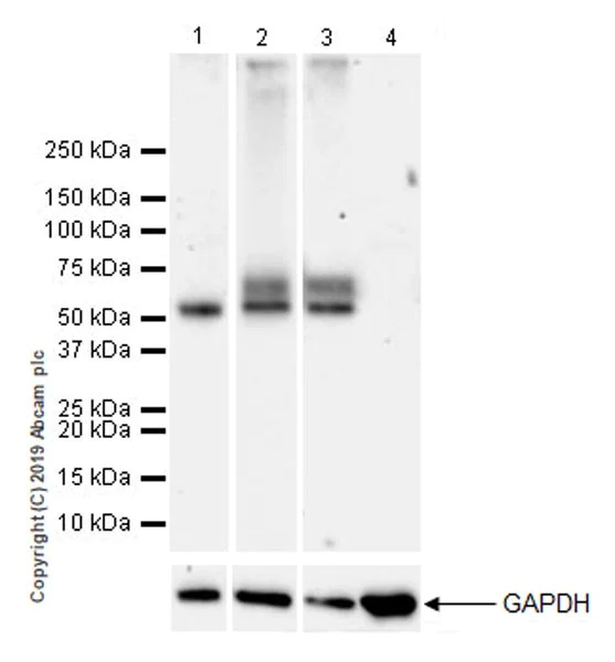 Western blot - Anti-IL-13 receptor alpha 2 antibody [EPR22978-163] (AB260044)